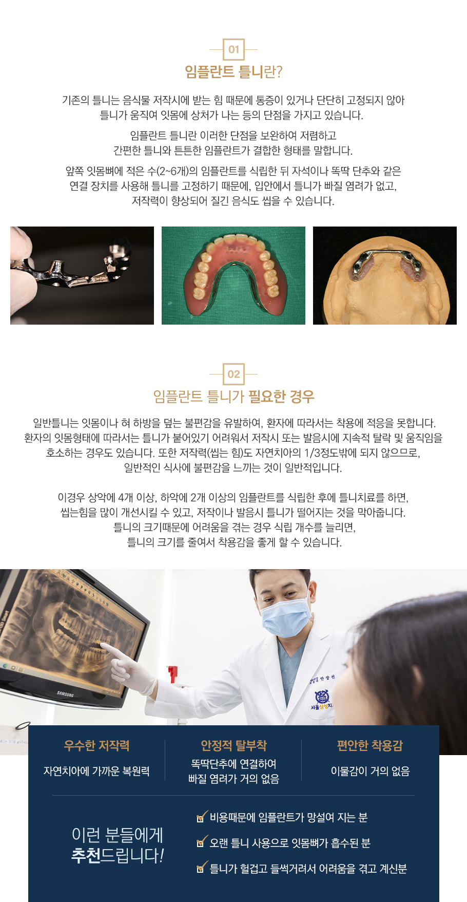 임플란트 틀니