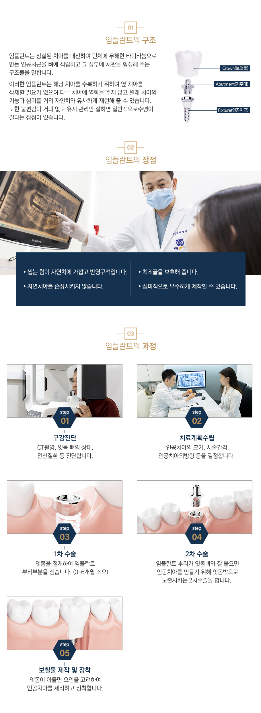 임플란트란