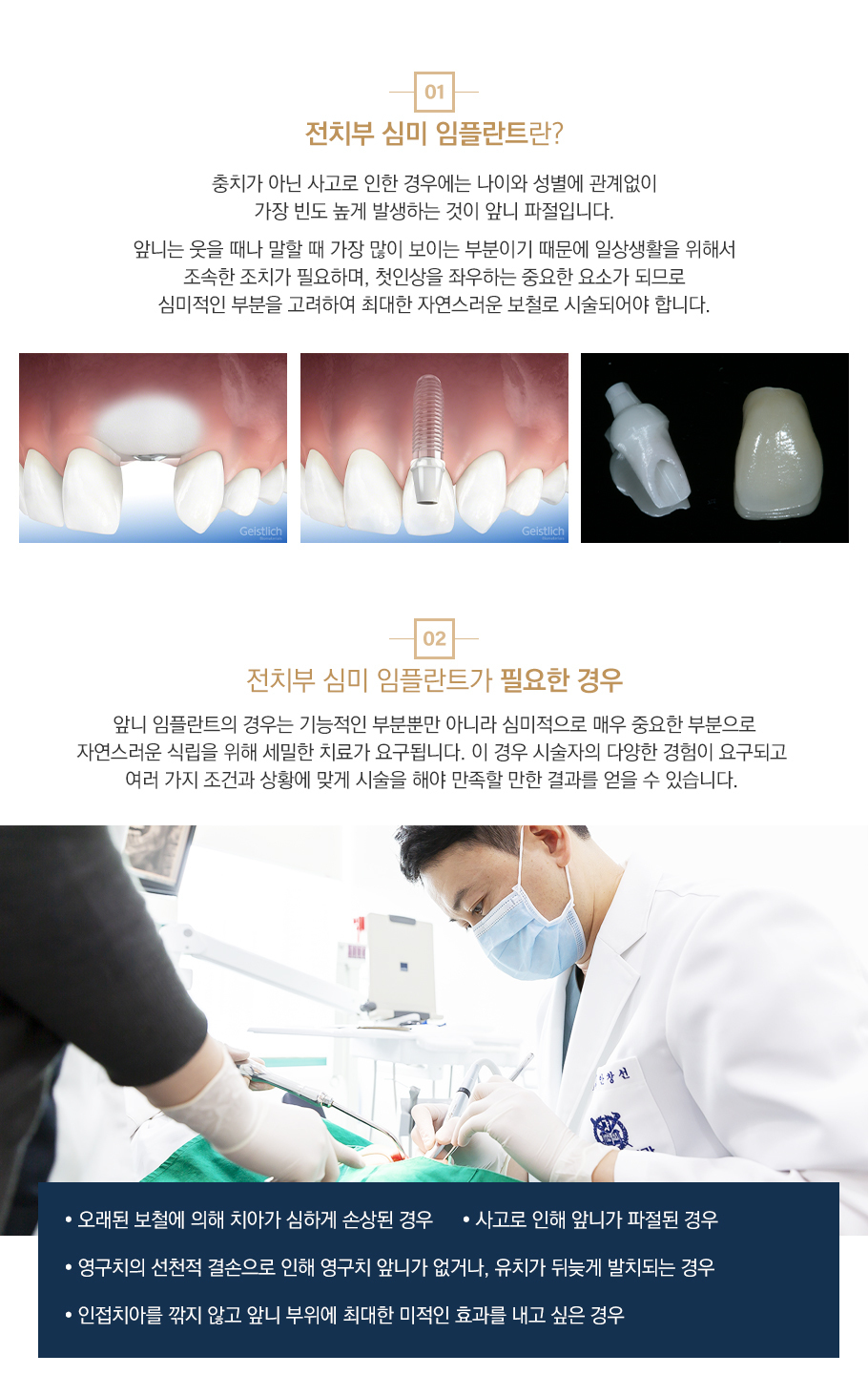 앞니심미임플란트