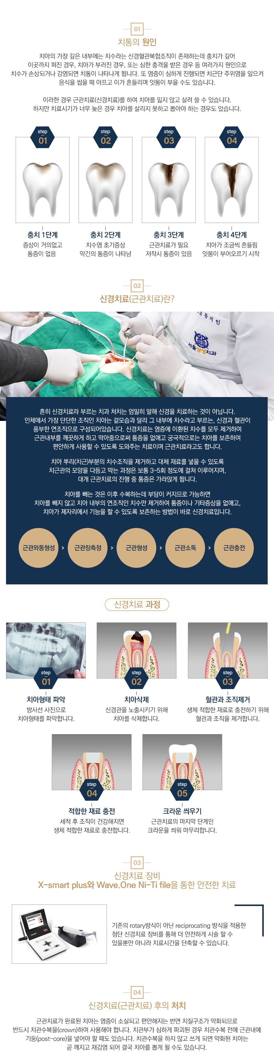 신경치료