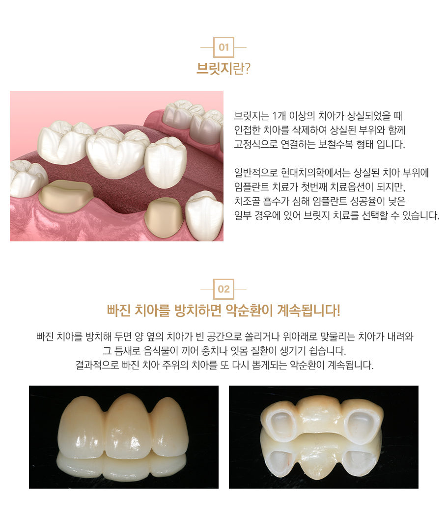 브릿지